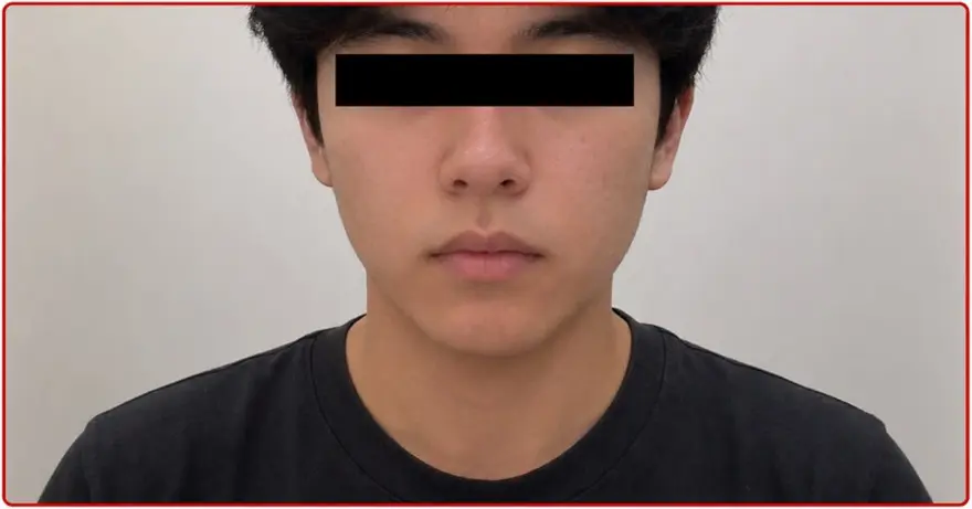 incorrect camera placement